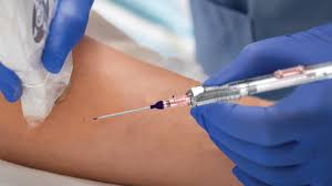 Image result for Peripheral IV Access