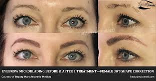 Best eyebrow microblading services orlando. Get Microblading And Permanent Makeup In Doylestown Beauty Marx Aesthetic Medspa