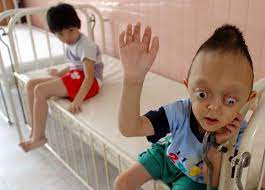 And vietnam began to work together to address the legacy of agent. Vietnamkrieg Agent Orange Ist Noch Im Dienst