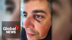 "Punched in the face": BC paramedic attacked