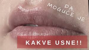 Lokalno se stavlja i led, da bi efekat anestezije bio jači kao i da bi se smanjila mogućnost pojave modrica na mestima ubrizgavanja hijalurona. Povecanje Usana Dr Stojicevic Dr Nedeljkovic