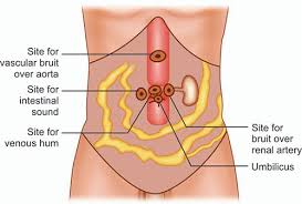 Image result for Venous Hum