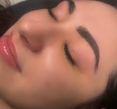 Introduction to Radiant Skin Esthetics services