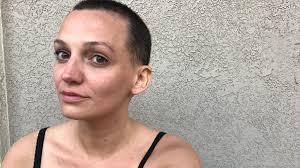 Quarantine Helped Me Confront My Fear of Hair Loss