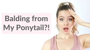 Hairline Saving Ponytail Hack No More Thinning Or Balding Youtube Hairline Hair Hacks Thinning Hairline
