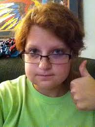 I took a pic of my legs to document swelling and I gained a face