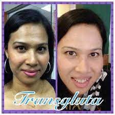 Jenis pemutih dengan cara itu adalah alternatif dari krim serta lotion pemutih yang juga banyak program suntikan vitamin c mempunyai tujuan untuk membuat kulit lebih cerah dan membuat kulit walaupun dikerjakan atau disuntikkan oleh ahlinya, tetap saja yang menjadi permasalahan paling. Transgluta By Zenia Rahsia Memutihkan Kulit Satu Badan Ayue Idris