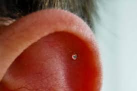 Symptoms are pain, redness, crusting and swelling at the earring site. Why Has My Piercing Got Infected Chemist Druggist