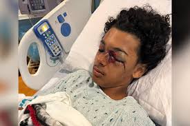 Fundraiser for Megan Wilkes by Rachel Buell : Cameron's Road To Recovery