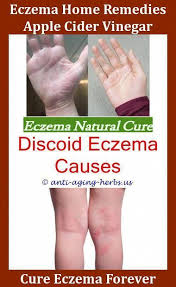 Aquaponics Bacteria Smallaquaponicssystem Eczema Symptoms Eczema Treatment Best Eczema Treatment