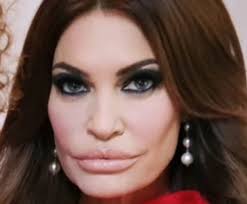 Kim is going for Jocelyn Wildenstein 2.0. Which is ironic given their  stance