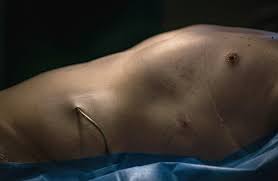 Patrick Junker sensibilisiert mit seiner Reportage für die Organspende