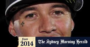 Jackson Strong, motocross star, in hospital after backyard fireworks mishap