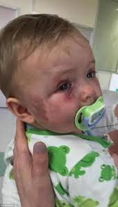 Bashed Adelaide toddler Evie McMahon smiling and happy less than two years  after being attacked