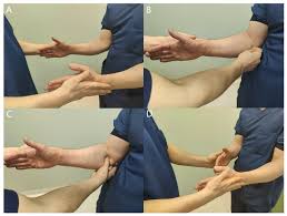 Image result for Carpal Compression Test