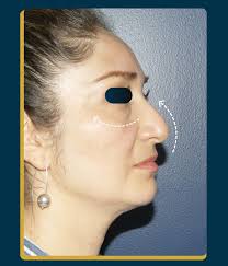 Cirujano plástico Quito