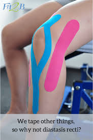 The tape should promote joint awareness and give a feeling of support, especially when flexing the knee during an exercise like a squat. Taping Diastasis Recti How To Use Kinesiology Tape On Separated Abs Fit2b Studio