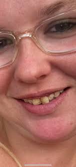 hi guys in which college I can do dental therapy..I passed with B?? plz  help guyz