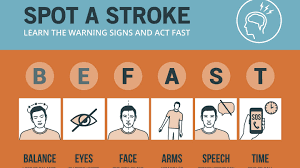 Minimising Your Risk Of Stroke During Pandemic Is Crucial – The Irish Times