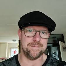 I'm tired of men rejecting me because of my vitiligo 😔 it's heartbreaking