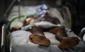 Uruguay registra un caso del letal hongo negro en un paciente con coronavirus. Ui5e1y7es4xwcm
