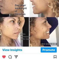 CATO ADVANCED SKIN CARE