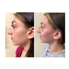 John Lazor MD (@drjohnlazor) · Weymouth, MA