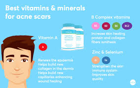 Vitamin e can also help reduce wrinkles and make your skin look and feel smoother. Best Vitamin Supplements For Acne Scars Mdacne