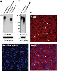 Bonn nuì, v tomto slove je „n zvuk. Glcnac6st3 Is A Keratan Sulfate Sulfotransferase For The Protein Tyrosine Phosphatase Ptprz In The Adult Brain Scientific Reports