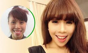 Biên Đạo múa Lan Nhi đẹp "vạn người mê" sau phẫu thuật hàm hô