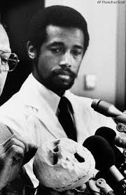 Ben Carson performed historic conjoined twin separation surgery 30 years  ago