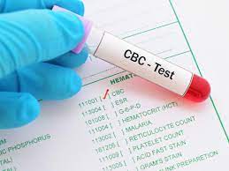 A blood test for pregnancy should include more information than the simple result of pregnant or not pregnant. High Mchc Causes Treatment And Symptoms