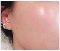 Glass Skin Is The Latest Korean Beauty Trend How To Make Glass Skin Howtomakeglassskin This Viral Trend In In 2021 Korean Beauty Trends Glass Skin Beauty Hacks
