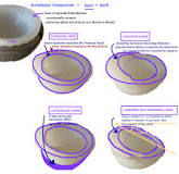 ACETABULUM LINER — Hip & Knee Book