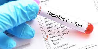 Home › test, evaluate, monitor testing, evaluation, and monitoring of hepatitis c the following pages address testing, evaluation, and monitoring of patients with hcv before, during and after antiviral therapy. Hepatitis C Virus Hcv Test Adventist Healthcare Fort Washington Md
