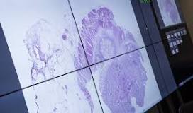 Image result for what is medical microbiology course