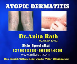 Pin By Dipti Soren On Skin Specialist In Bhubaneswar Odisha Skin Care Clinic Skin Tightening Treatments Skin Clinic
