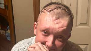 Fundraiser by C Weimer : Support Skyes Recovery From Traumatic Brain Injury