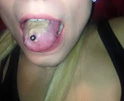 Zungenpiercing Entzundet Oder Ist Es Normal Piercing Zunge
