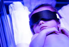 Care of a baby under phototherapy : Phototherapy For Treating Neonatal Jaundice Process Risks Complications