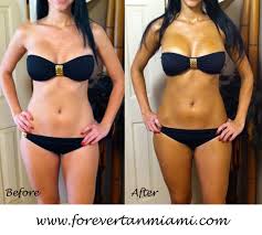 Airbrush Tanning Forever Tan Miami Forevertanmiami