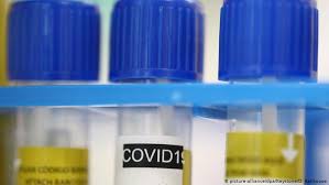 Die spezifität des tests liegt bei 99,9 % und die sensitivität bei 96,17 %. Bosch Stellt Coronavirus Schnelltest Vor Aktuell Deutschland Dw 26 03 2020