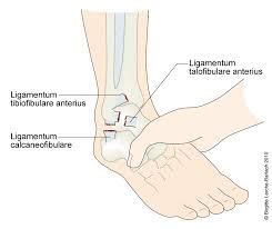 Ankel Ruptur Af Ligamentum Talofibulare Og Calcaneofibulare Patienthandbogen Pa Sundhed Dk