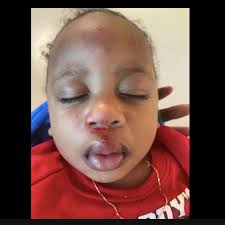 Baby injured by falling out of police car after being taken from home in  controversial SWAT raid