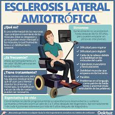Los síntomas de esclerosis lateral amiotrófica. Doktuz Sabias Que La Esclerosis Lateral Amiotrofica Facebook