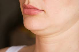 Akibatnya mereka yang memiliki double chin menjadi terlihat gemuk dan bikin nggak percaya diri, khususnya bagi kaum hawa. Rasa Malu Sebab Ada Double Chin Ini 7 Petua Anda Boleh Cuba Pesona Pengantin