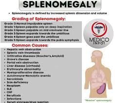 Image result for Splenomegaly