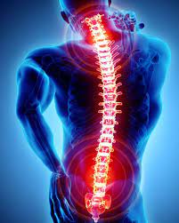 Masalah tulang seperti artritis sampai penyempitan tulang belakang dapat menyebabkan sakit di salah satu bagian punggung. Rawatan Sakit Belakang Berkesan Physiomobile My