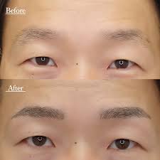 水の森美容外科