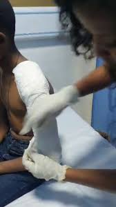 ዶ/ር ናርዶስ-የህጻናት አጥንት ህክምና